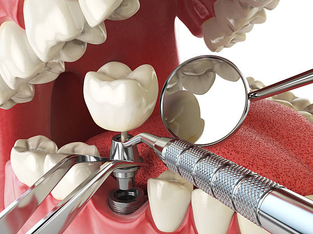 Best Emergency Dental Services for Seniors in Waggaman, LA